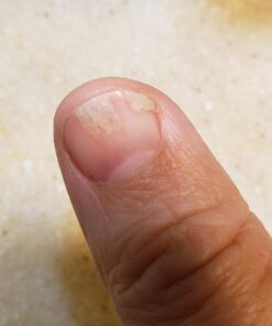 NZ Country Manuka Oil | 100% Pure Organic Essential Oil | Natural and Effective Skin Care | Plant Therapy Essential Oils for Body, Nails, Hair, Skin & Lips | 35x Stronger Than Organic Tea Tree Oil 38 61E c1KacsL