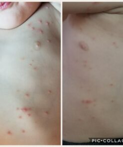 Healing Solutions 10ml Oils - Thuja Essential Oil - 0.33 Fluid Ounces 0.33 Fl Oz (Pack of 1) 24 61E7I1OiRkL