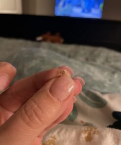 Compound W One Step Wart Remover Strips for Kids, 10 Medicated Strips for Wart Removal, 2 Pack unflavored 10 Count (Pack of 2) 56 61E9mGeBNnL