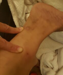 emuaid Ointment 2oz- Eczema Cream. Regular Strength Treatment. Regular Strength for Athletes Foot, Psoriasis, Jock Itch, Anti Itch, Rash, and Skin Yeast Infection. 15 61EN1vzd0L