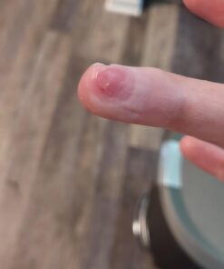 Compound W Wart Remover Maximum Strength One Step Pads, 14 Medicated Pads 14 Count (Pack of 1) 64 61EQ2ouR aL