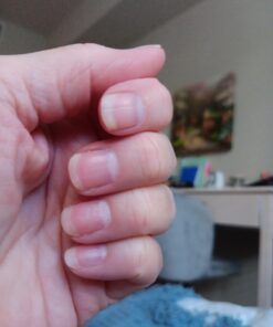 Amazon Elements Vegan Biotin 5000 mcg - Hair, Skin, Nails, 130 Capsules (4 month supply) (Packaging may vary) 29 61ERolECWCL