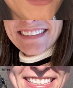 PHILIPS Zoom Nite White 22% 3 Syringes 15 61EzyBGzslL