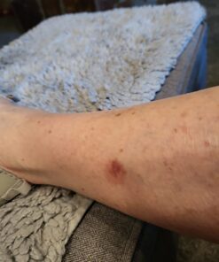 Terrasil Wound Care - 3X Faster Healing, Infection Protection Ointment for bed sores, pressure sores, diabetic wounds, ulcers, cuts, scrapes, and burns (14 gram tube) 51 61FOq2i mL