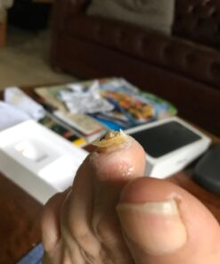 PURELY NORTHWEST-Tea Tree Oil & Peppermint Foot Soak with Epsom Salt-for Stubborn Foot Odor, Athletes Foot Burning & Itching, Damaged Discolored Nails-A Natural Callus Remover 16 Ounces 1 Pound (Pack of 1) 43 61G76 wTWqL