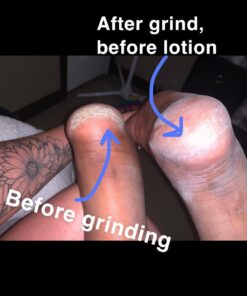 Amope Pedi Perfect Electronic Foot File, Dual-Speed Callus Remover (with Diamond Crystals) for Feet (Extra Coarse - Pink Gadget). -Perfect for In-home Pedicure for Baby Smooth Feet. Battery Operated 34 61GFmDlQgL