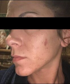 L'Oréal Paris Revitalift Bright Reveal Anti-Aging Exfoliating Peel Pads with Glycolic Acid, Reduce Wrinkles & Brighten Skin, 30 Count (Pack of 1) 39 61HMURrEhzL