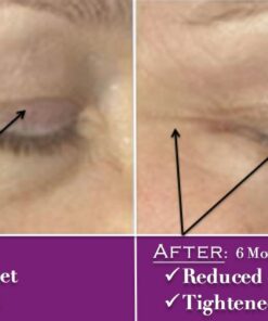 PUREST Natural & Organic Hyaluronic Acid with Vitamin C and E - WRINKLE ERASER & Collagen Builder. 13 61HeALe0aAL