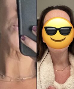 Art Harding's Instant Face & Neck Lift (Dark) - Chemical-Free, Hypoallergenic, for All Skin Types Dark 23 61HmnOy3L1L