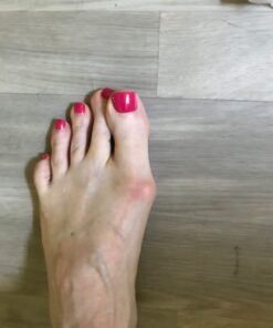 ZenToes Gel Toe Separators for Overlapping Toes, Bunions, Big Toe Alignment, Corrector and Spacer - 4 Pack (White) White 29 61HnPebs4kL