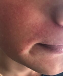 NZ Country Manuka Oil | 100% Pure Organic Essential Oil | Natural and Effective Skin Care | Plant Therapy Essential Oils for Body, Nails, Hair, Skin & Lips | 35x Stronger Than Organic Tea Tree Oil 33 61HtCLhHKiL