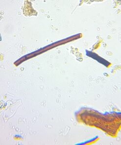 OMAX 40X-2000X LED Binocular Compound Lab Microscope w/ Double Layer Mechanical Stage + Blank Slides, Cover Slips, & Lens Cleaning Paper, M82ES-SC100-LP100 64 61J5dbG7FgL 1