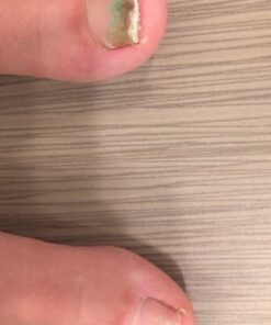 3 in 1 Professional Foot Spa Kit-with Tea Tree Foot & Body Soak-Tea Tree Body Wash & Nail Blend-Soothes Dry, Burning & Itchy Skin-Refreshes Unwanted Foot Odor-Restores Unhealthy Nails-Purely Northwest Tea Tree Oil 3 Piece Set 41 61JcsaMiEiL