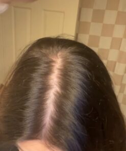 Amazon Elements Vegan Biotin 5000 mcg - Hair, Skin, Nails, 130 Capsules (4 month supply) (Packaging may vary) 31 61KAGXjpR6L