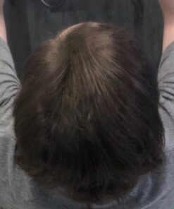 XFusion Keratin Hair Fibers - Black (Large Size 28g) Medium Brown 33 61KJrFecKfL