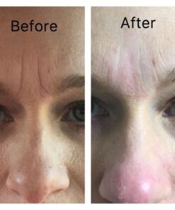 Facial Smoothies VARIETY Wrinkle Remover Strips, 160 anti wrinkle patches in 6 shapes 42 61KXyaunbxL