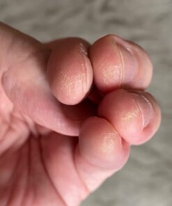 Rock Tips Liquid Callus Formula for musicians 18 61KdfET6KdL