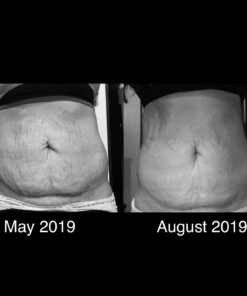 WeightLoss-Solutions Lipo-Boost Cellulite Cream with Caffeine is an Advanced Firming Lotion for Thighs and Butt, Stomach, Belly, Breasts, and Arms, to Smooth, Firm, Tone, and Tighten 19 61KitkPwvL