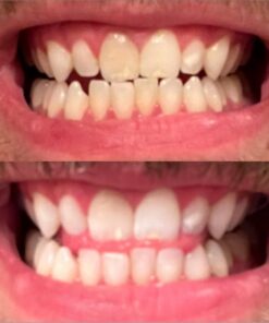 Hello Activated Charcoal Epic Teeth Whitening Fluoride Free Toothpaste, Fresh Mint and Coconut Oil, Vegan, SLS Free, Gluten Free and Peroxide Free, 4 Ounce 4 Ounce (Pack of 1) 41 61KoZODxVrL