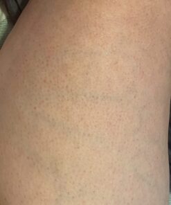 CSM Dry Body Brush for Beautiful Skin - Solid Wood Frame & Boar Hair Exfoliating Brush to Exfoliate & Soften Skin, Improve Circulation, Stop Ingrown Hairs, and Reduce The Appearance Cellulite 56 61L8vyA5wBL