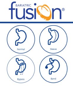 Bariatric Fusion Bariatric Multivitamin Soft Chew | Cherry Pineapple Flavor | Chewy for Post Bariatric Surgery Patients Including Gastric Bypass and Sleeve Gastrectomy | 60 Count | 1 Month Supply 16 61LHLslgkZL 4