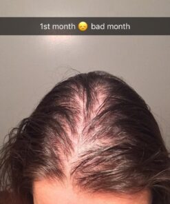 Newopure: Natural Hair Growth Vitamins, Repairs Hair Follicles, Stops Hair Loss, Blocks DHT, Stimulates New Hair Growth, Promotes Thicker, Fuller and Faster Growing Hair. Men & Women (30 Day Supply) 22 61Loo3nIKNL