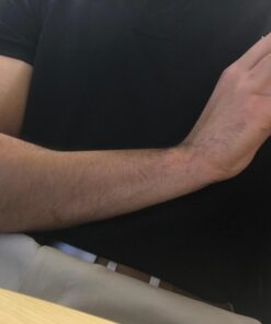 Airisland Finger Stretcher Hand Resistance Bands Hand Extensor Exerciser Finger Grip Strengthener Strength Trainer Gripper Set for Arthritis Carpal Tunnel Exercise Guitar and Rock Climbing 3pcs 30 61LvQPec4AL