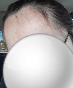 Hair Growth Vitamins With Saw Palmetto for Women-DHT Blocker,Hair Growth Supplement for Thicker And Perfect Hair.Hair Growth Pills for Thinning Hair.Get Healthy,Glow,Longer,Thick Hair.With Biotin. 37 61M2lshAK0L