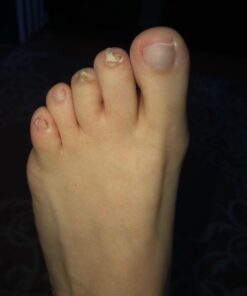 PURELY NORTHWEST-Tea Tree Oil & Peppermint Foot Soak with Epsom Salt-for Stubborn Foot Odor, Athletes Foot Burning & Itching, Damaged Discolored Nails-A Natural Callus Remover 16 Ounces 1 Pound (Pack of 1) 39 61My4trp51L