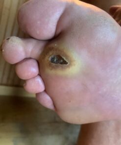 Terrasil Wound Care - 3X Faster Healing, Infection Protection for Bed sores, Pressure sores, Diabetic Wounds, Foot, Leg ulcers, cuts, scrapes, Burns - 50gm Tube 27 61N2Bto16UL