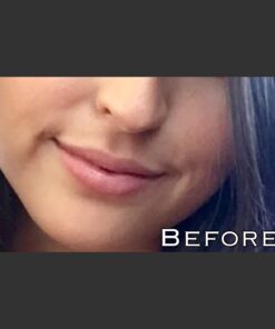 Fullips Lip Plumper Tool - Medium Oval with Bonus Large Round Enlarger - Self Suction Plumping Device For Fuller Lips - Plump in Seconds - Natural Instant Lip Enhancement Kit - Red Plastic Plumpers 45 61N9ygXoZPL