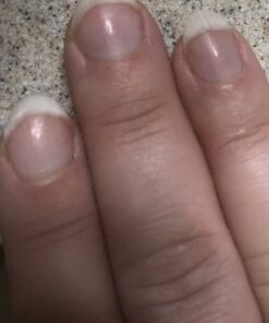 vitafusion Extra Strength Biotin Gummy Vitamins, Berry Flavored, 5,000 mcg Biotin Vitamins, America’s Number 1 Gummy Vitamin Brand, 50 Day Supply, 100 Count (Packaging may vary) 50 61NBgfarCgL