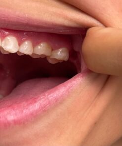 TheraBreath Healthy Gums Mouthwash, Clean Mint, Antigingivitis, Dentist Formulated, 16 Fl Oz (2-Pack) 16 Fl Oz (Pack of 2) 32 61NKkmOTawL