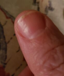 NZ Country Manuka Oil | 100% Pure Organic Essential Oil | Natural and Effective Skin Care | Plant Therapy Essential Oils for Body, Nails, Hair, Skin & Lips | 35x Stronger Than Organic Tea Tree Oil 39 61NY9lUUzcL