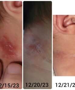 Active Skin Repair - First Aid Natural & Non-Toxic Healing Ointment & Antiseptic Spray for Minor Cuts, Wounds, Scrapes, Rashes, Sunburns, and Other Skin Irritations (Bundle, Combo, 3 oz Each) 3 Fl Oz (Pack of 2) 15 61Na8J87lL