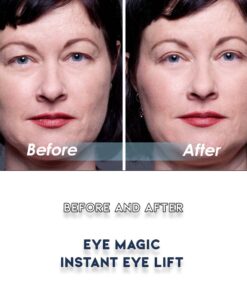 Eye Magic Original Eye Lift Kit (Small/Medium Size With Gel) Lifts Eyelid Droop and Hooded Eyes | Open And Show Off Your Beautiful Eyes | Made In America 13 61OFj5j54hL