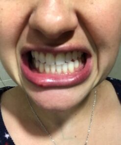 PHILIPS Zoom Nite White 22% 3 Syringes 17 61OeK6aGBAL