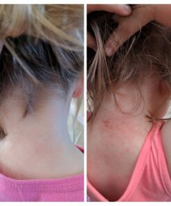 Flora - Toddler's Blend Probiotic, 3 Billion CFU RAW, Six-Infant & Toddler Specific Strains, Lactobacillus, Taste-Free, Dissolves Easy, Aids Constipation and Immunity, 2.64-oz. Powder Standard Packaging 17 61PkS7lxrFL