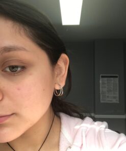 Tea Tree Essential Oil, 1 Fl Oz with Dropper - Undiluted Therapeutic Grade for Your Face, Skin, Hair and Diffuser - 100% Pure Melaleuca Oil for Acne, Toenails - by Pure Body Naturals 1 Fl Oz (Pack of 1) 34 61Q7LWI3usL