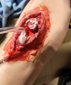 Woochie Broken Bone 3 61R8TGbRqyL