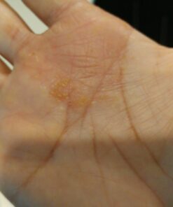 Moisturising Cream, Body and Face Moisturizer for Dry Skin, Acne Cream, 2PC 0.53 Ounce (Pack of 1) 47 61RIxTRcOjL