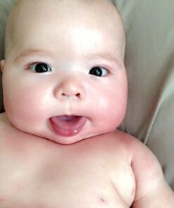 Cetaphil Pro Restoraderm Gentle Body Moisturizer, Eczema Calming, 10-Fluid Ounces 10 Ounce (Pack of 1) 22 61SsoTpC9iL