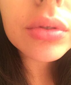 Fullips Lip Plumper Tool - Medium Oval with Bonus Large Round Enlarger - Self Suction Plumping Device For Fuller Lips - Plump in Seconds - Natural Instant Lip Enhancement Kit - Red Plastic Plumpers 47 61TDOV2c6FL