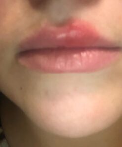 Dr. Dan's Cortibalm - 1 Pack - for Dry Cracked Lips - Healing Lip Balm for Severely Chapped Lips - Designed for Men, Women and Children 0.14 Ounce (Pack of 1) 29 61TI2JHgu6L