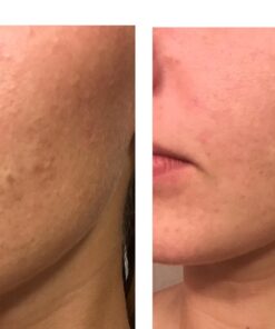 Era Organics Manuka Honey Face Cream - Advanced 12-in-1 Nourishing and Rejuvenating Daily Face Moisturizer for Women and Men - Face Moisturizer for Sensitive Skin - Body Moisturizer for Dry Skin 4 oz Regular 4 Ounce (Pack of 1) 41 61TJhnPaSCL