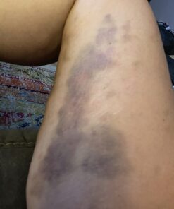 Coolife Fascia Muscle Roller - Cellulite Massager - Fascia Roller for Cellulite and Sore Muscles - Neck, Leg, Back, Body Roller Deep Tissue Massage Stick Tools - 3 Balls Size Version. Mint Green 42 61Ti96y821L