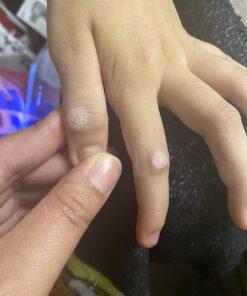 Compound W One Step Wart Remover Strips for Kids, 10 Medicated Strips for Wart Removal, 2 Pack unflavored 10 Count (Pack of 2) 37 61V7u25mUML