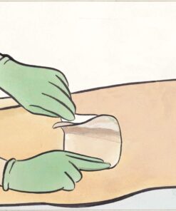 Medline Exuderm Odorshield Hydrocolloid Wound Dressing, 2" x 2" (Pack of 10) 16 61V9mxkJrLL