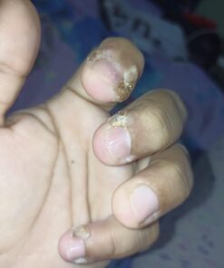 Dr. Scholl's Dual Action Freeze Away WART Remover, 8 Applications // Freeze Therapy + Powerful Fast Acting Salicylic Liquid to Remove Common and Plantar Warts, 0.33 Fl Oz, 1 Count 45 61VqAFrm5GL