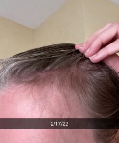 BeLive Biotin Gummies with MultiVitamins, Folate, Inositol – Supports Hair Growth, Healthy Skin & Nails – Vegan, Pectin Based – Strawberry Flavor (1) 60 Count (Pack of 1) 36 61WgkGiep5L